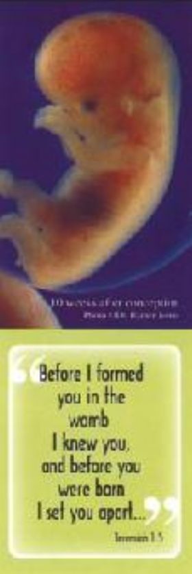 Bookmark - Before I Formed You In The Womb I Knew You - Pack of 100