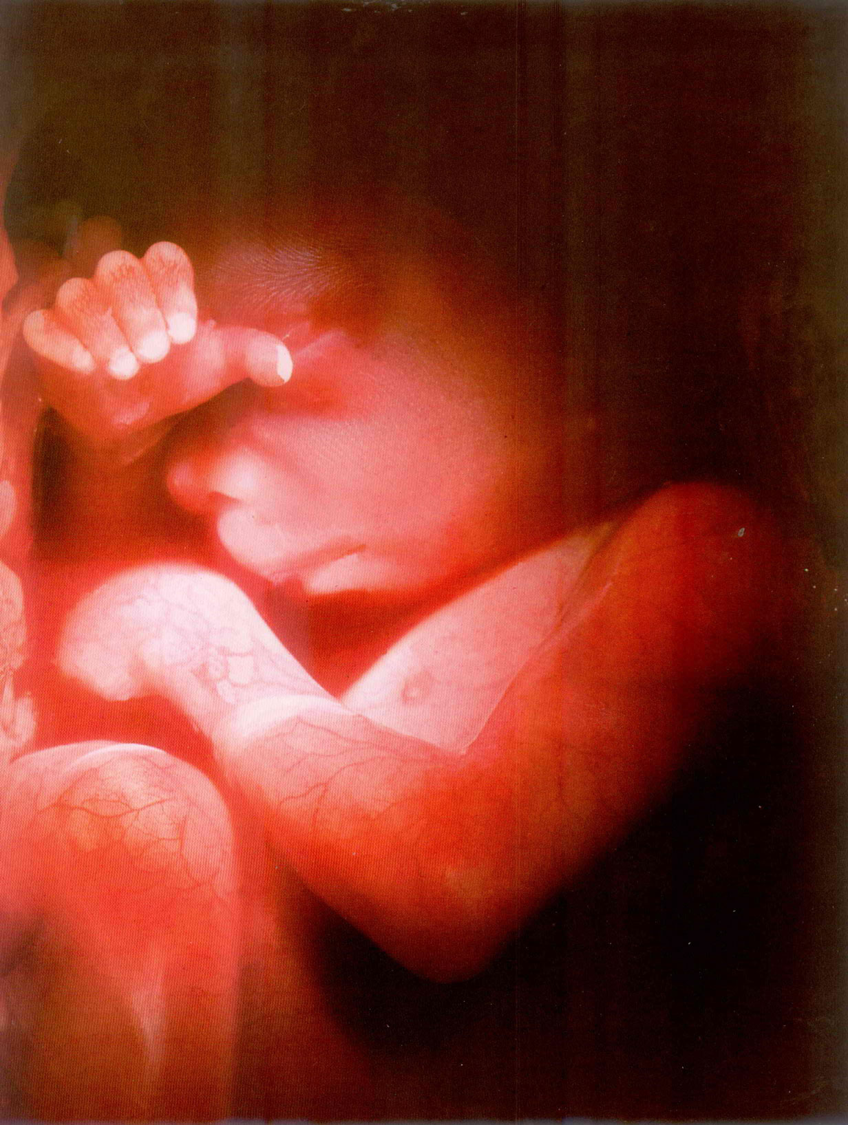 Book - Being Born-45