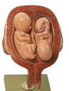 SOMSO Twins Fetal Development Model