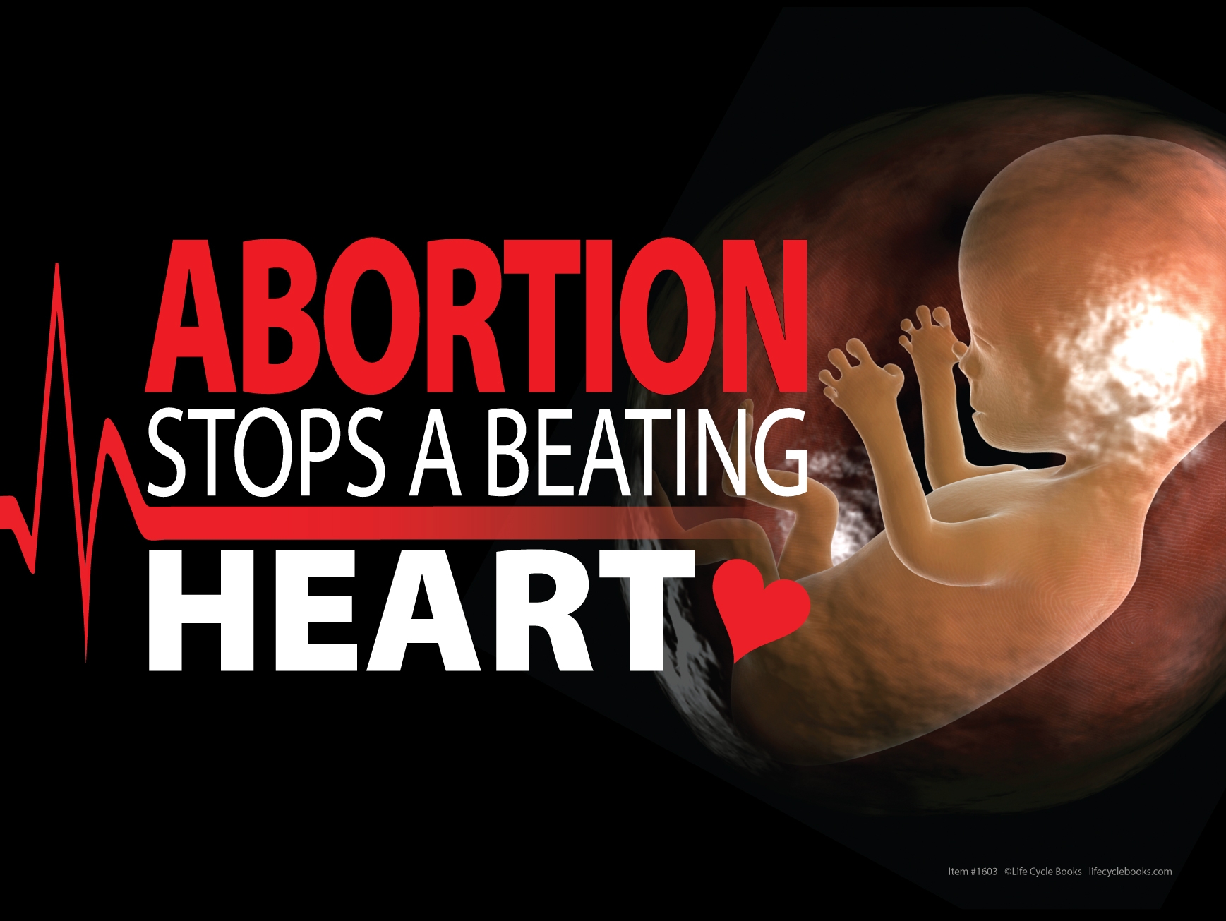 Rally Sign - Abortion Stops A Beating Heart - 24" by 16"