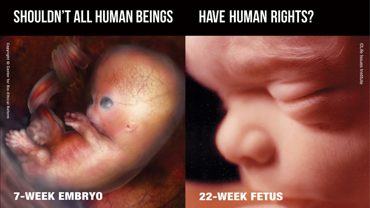 Postcard Human Rights - Cover