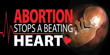 Banner - Abortion Stops A Beating Heart - 8' by 4'