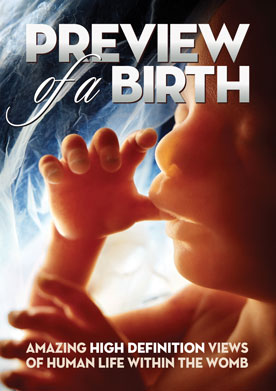 DVD - Preview of a Birth